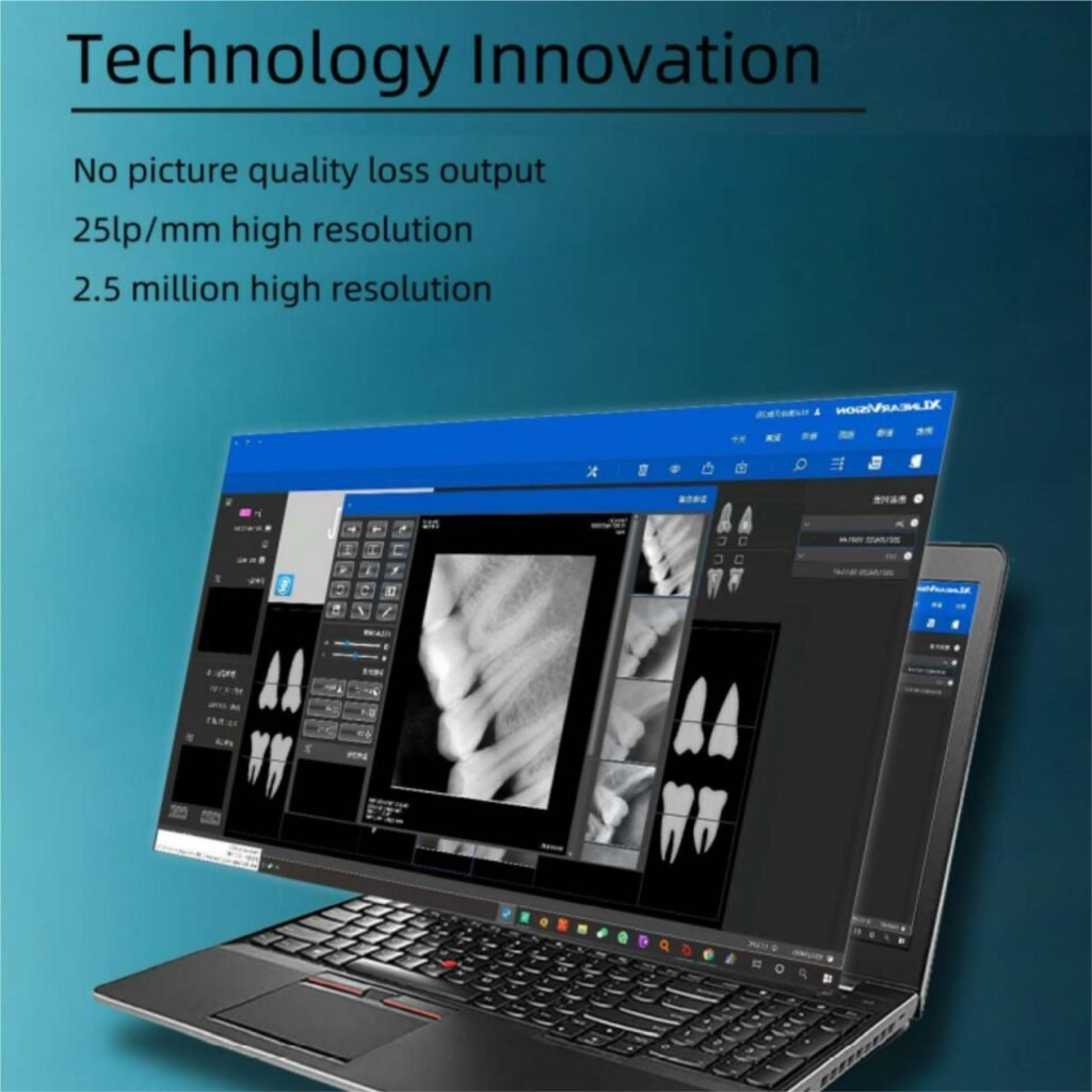 Appledental Eco Sensor2Digital Dental XRAY Imaging System,RVG Best